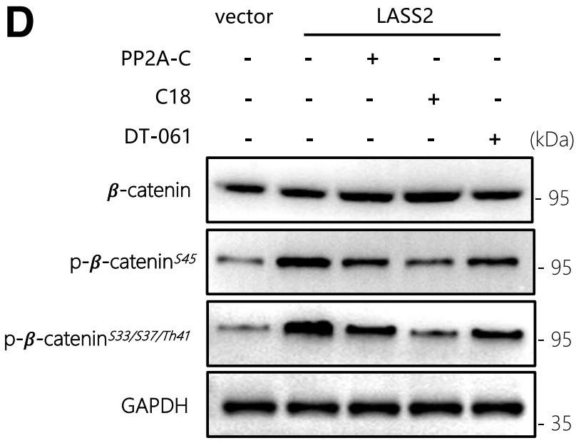 PP2A was activated in LASS2-overexpressing BCSCs.jpg